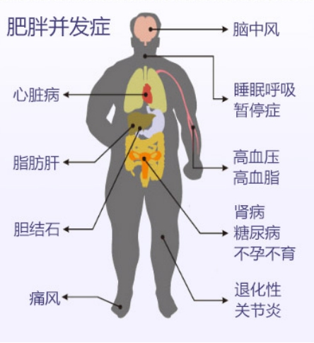 糖尿病占人口比例_动力之一:糖尿病发病人数逐年上升,知晓率和治疗率逐步提(3)